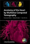 Francesco Faletra, Natesa Pandian, Siew Yen Ho  Anatomy of the Heart by Multislice Computed Tomography