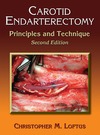 Christopher M.L.  Carotid Endarterectomy: Principles and Technique