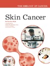 Po-lin So  Skin Cancer (The Biology of Cancer)