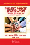 Kuiken T., Feuser A., Barlow A.  Targeted Muscle Reinnervation: A Neural Interface for Artificial Limbs