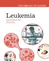 D. M. Bozzone  Leukemia (The Biology of Cancer)
