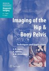 A. M. Davies (Editor), K. Johnson (Editor), R.W. Whitehouse  Imaging of the Hip & Bony Pelvis: Techniques and Applications (Medical Radiology Diagnostic Imaging)