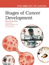 Paraic A., Ph.d. Kenny  Stages of Cancer Development (The Biology of Cancer)