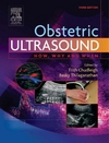 Chudleigh T.  Obstetric ultrasound: how, why, and when