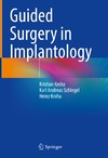 Kristian Kniha, Karl Andreas Schlegel, Heinz Kniha  Guided Surgery in Implantology